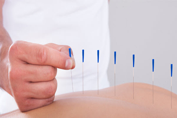 châm cứu tại nhà Đà Nẵng